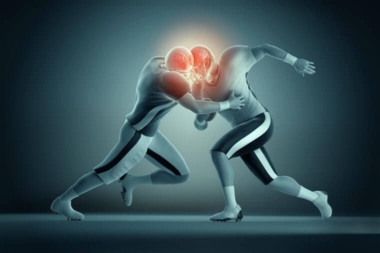 Myths About Concussions Learningrx Iplay America